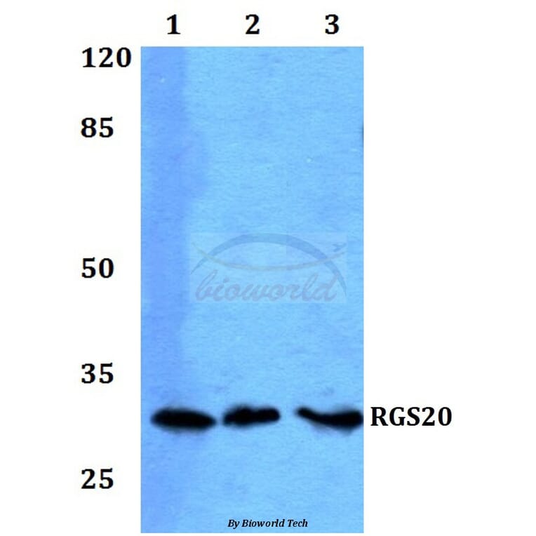 Anti-RGS20 Antibody from Bioworld Technology (BS60230) - Antibodies.com