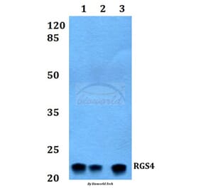 Anti-RGS4 Antibody from Bioworld Technology (BS60231) - Antibodies.com