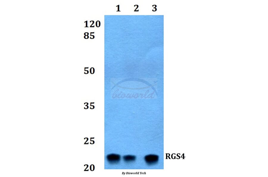 Anti-RGS4 Antibody from Bioworld Technology (BS60231) - Antibodies.com