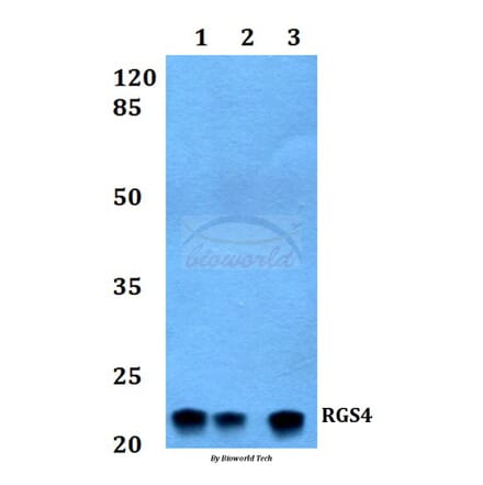 Anti-RGS4 Antibody from Bioworld Technology (BS60231) - Antibodies.com