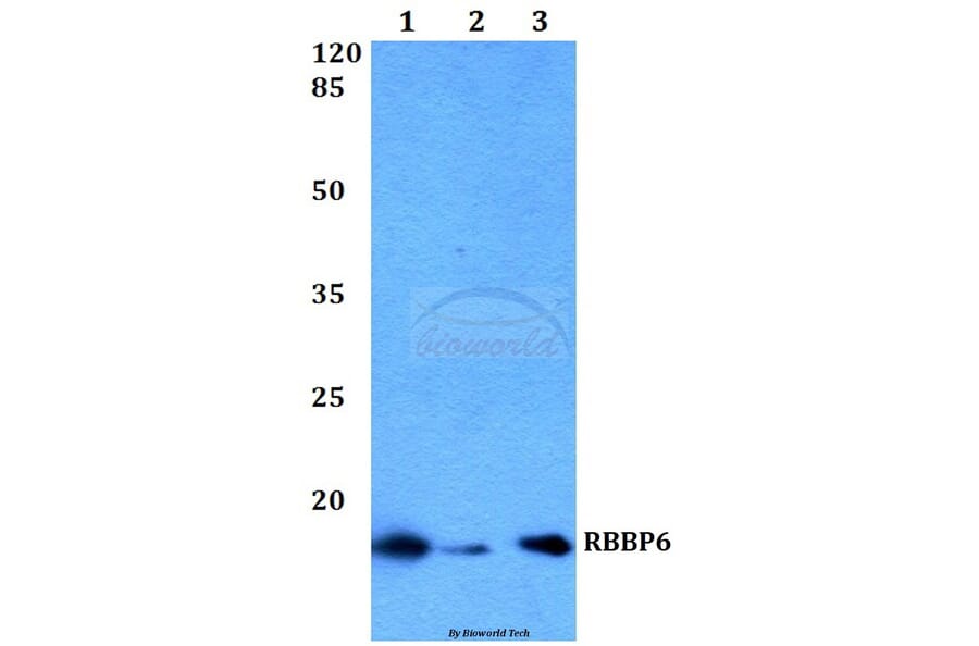 Anti-RBBP6 Antibody from Bioworld Technology (BS60233) - Antibodies.com