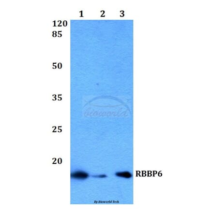 Anti-RBBP6 Antibody from Bioworld Technology (BS60233) - Antibodies.com