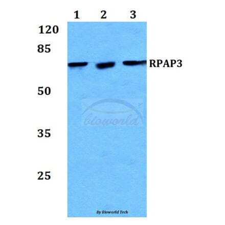 Anti-RPAP3 Antibody from Bioworld Technology (BS60239) - Antibodies.com