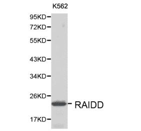 Anti-RAIDD Antibody from Bioworld Technology (BS6024) - Antibodies.com