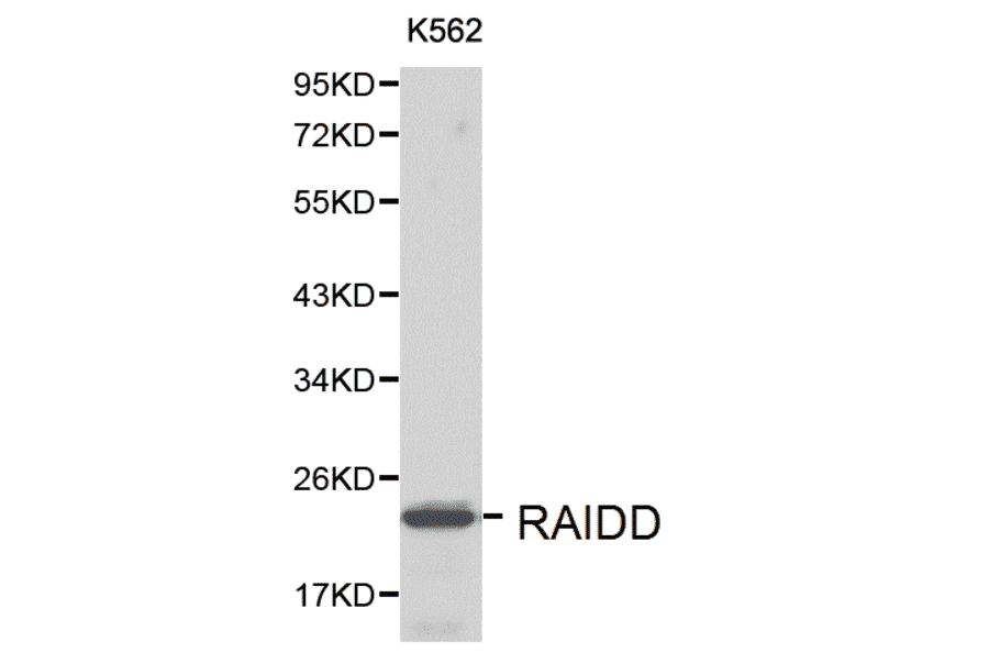 Anti-RAIDD Antibody from Bioworld Technology (BS6024) - Antibodies.com