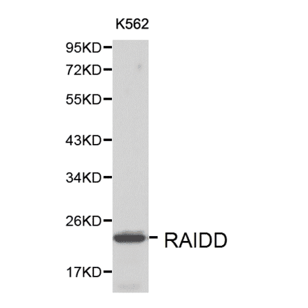 Anti-RAIDD Antibody from Bioworld Technology (BS6024) - Antibodies.com