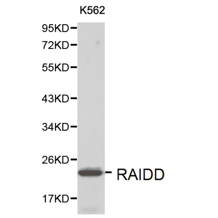 Anti-RAIDD Antibody from Bioworld Technology (BS6024) - Antibodies.com