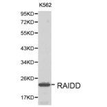 Anti-RAIDD Antibody from Bioworld Technology (BS6024) - Antibodies.com