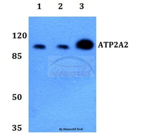 Anti-ATP2A2 Antibody from Bioworld Technology (BS60240) - Antibodies.com