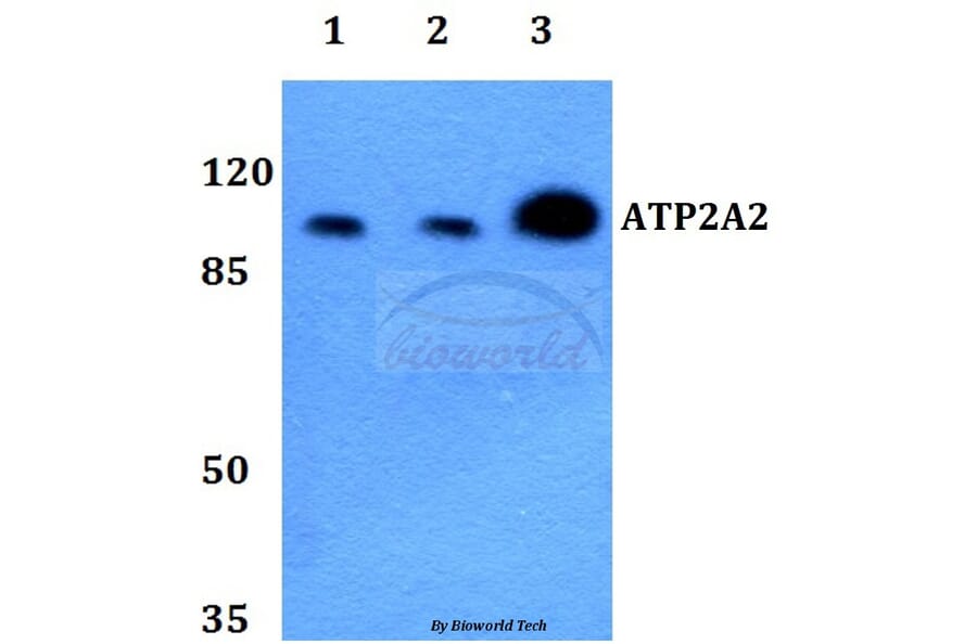 Anti-ATP2A2 Antibody from Bioworld Technology (BS60240) - Antibodies.com