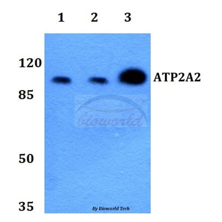 Anti-ATP2A2 Antibody from Bioworld Technology (BS60240) - Antibodies.com