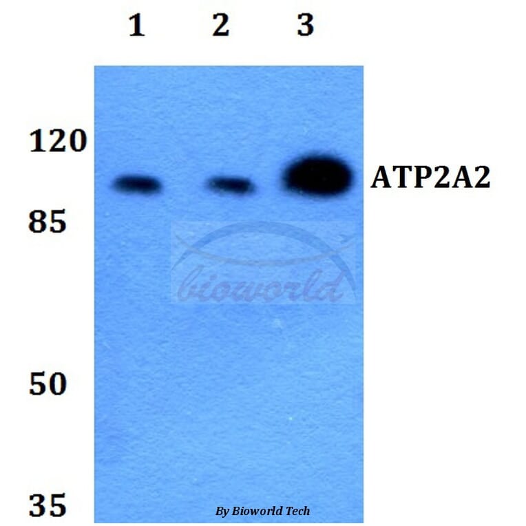 Anti-ATP2A2 Antibody from Bioworld Technology (BS60240) - Antibodies.com