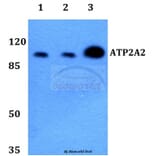 Anti-ATP2A2 Antibody from Bioworld Technology (BS60240) - Antibodies.com