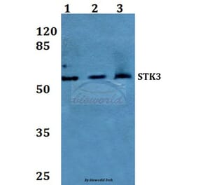 Anti-STK3 Antibody from Bioworld Technology (BS60241) - Antibodies.com