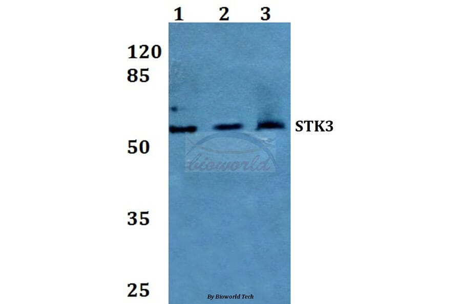 Anti-STK3 Antibody from Bioworld Technology (BS60241) - Antibodies.com