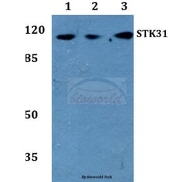 Anti-STK31 Antibody from Bioworld Technology (BS60242) - Antibodies.com