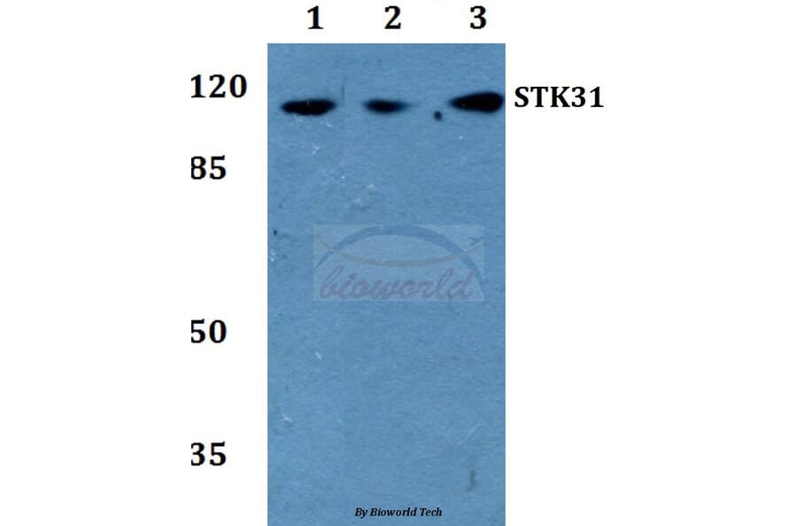 Anti-STK31 Antibody from Bioworld Technology (BS60242) - Antibodies.com