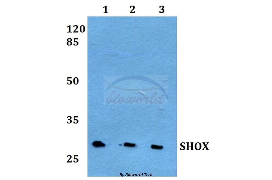 Anti-SHOX Antibody from Bioworld Technology (BS60246) - Antibodies.com