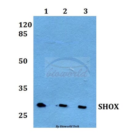 Anti-SHOX Antibody from Bioworld Technology (BS60246) - Antibodies.com