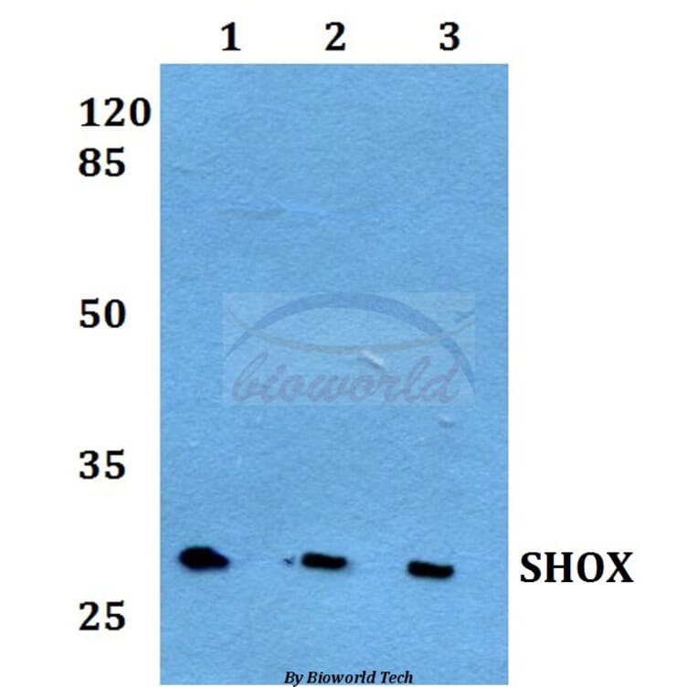 Anti-SHOX Antibody from Bioworld Technology (BS60246) - Antibodies.com
