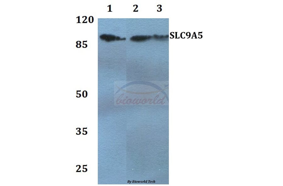 Anti-SLC9A5 Antibody from Bioworld Technology (BS60250) - Antibodies.com