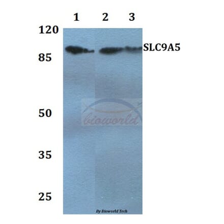 Anti-SLC9A5 Antibody from Bioworld Technology (BS60250) - Antibodies.com