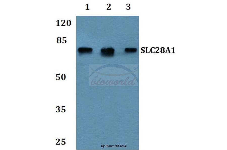 Anti-SLC28A1 Antibody from Bioworld Technology (BS60251) - Antibodies.com