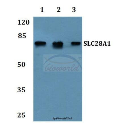 Anti-SLC28A1 Antibody from Bioworld Technology (BS60251) - Antibodies.com