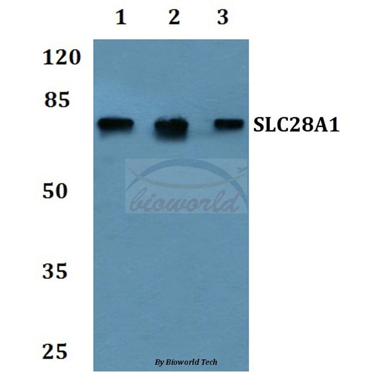 Anti-SLC28A1 Antibody from Bioworld Technology (BS60251) - Antibodies.com