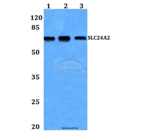 Anti-SLC24A2 Antibody from Bioworld Technology (BS60252) - Antibodies.com