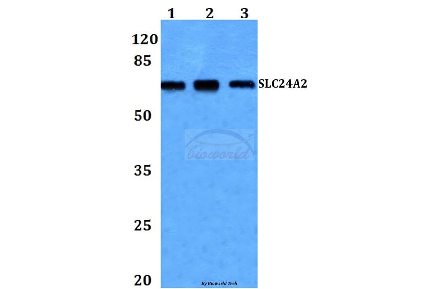 Anti-SLC24A2 Antibody from Bioworld Technology (BS60252) - Antibodies.com
