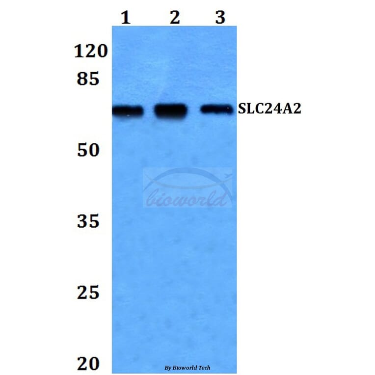 Anti-SLC24A2 Antibody from Bioworld Technology (BS60252) - Antibodies.com