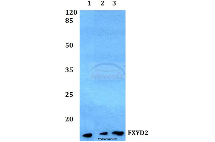 Anti-FXYD2 Antibody from Bioworld Technology (BS60253) - Antibodies.com