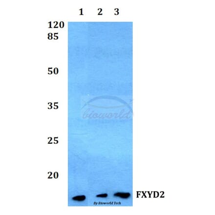 Anti-FXYD2 Antibody from Bioworld Technology (BS60253) - Antibodies.com