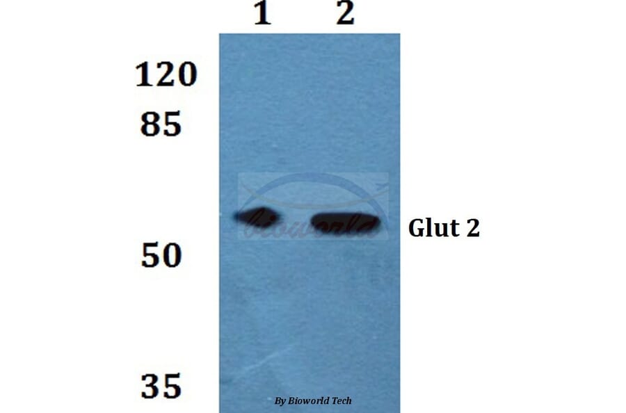 Anti-Glut 2 Antibody from Bioworld Technology (BS60254) - Antibodies.com