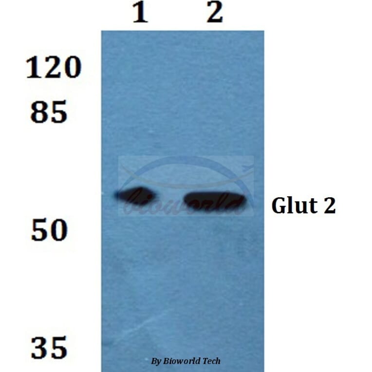 Anti-Glut 2 Antibody from Bioworld Technology (BS60254) - Antibodies.com
