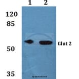 Anti-Glut 2 Antibody from Bioworld Technology (BS60254) - Antibodies.com