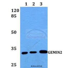 Anti-GEMIN2 Antibody from Bioworld Technology (BS60255) - Antibodies.com