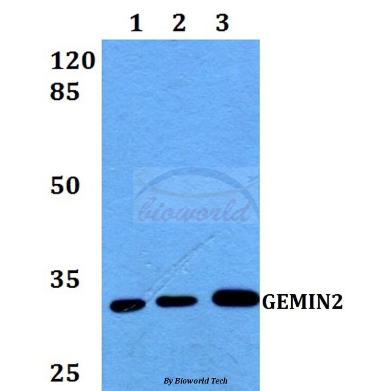 Anti-GEMIN2 Antibody from Bioworld Technology (BS60255) - Antibodies.com