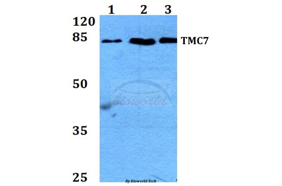 Anti-TMC7 Antibody from Bioworld Technology (BS60259) - Antibodies.com