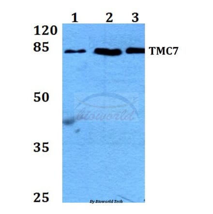 Anti-TMC7 Antibody from Bioworld Technology (BS60259) - Antibodies.com