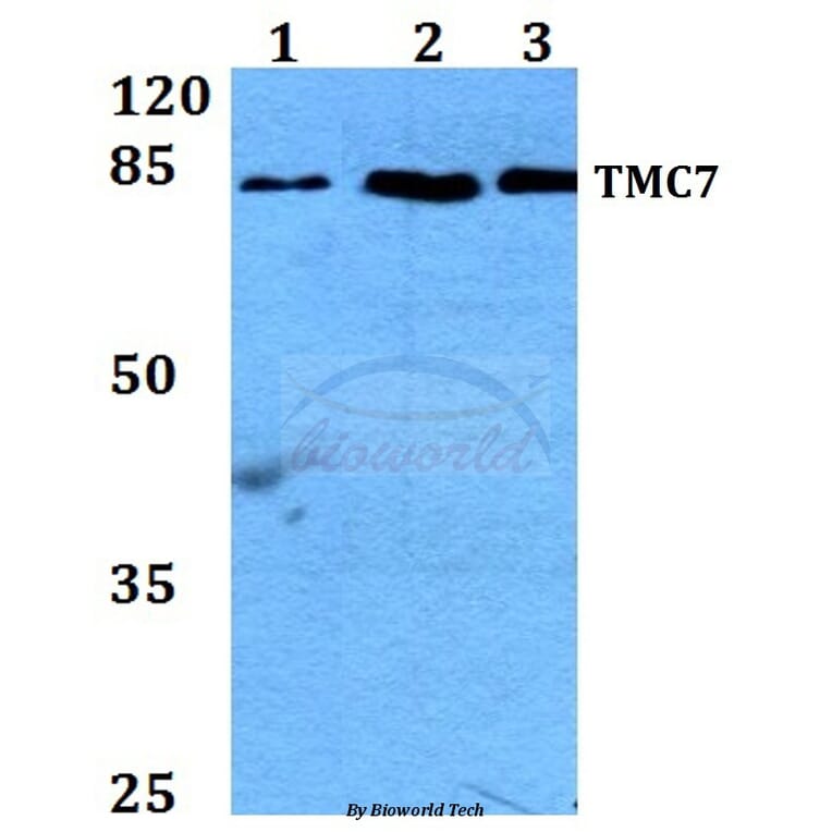 Anti-TMC7 Antibody from Bioworld Technology (BS60259) - Antibodies.com