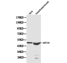 Anti-Cytokeratin 20 Antibody from Bioworld Technology (BS6026) - Antibodies.com