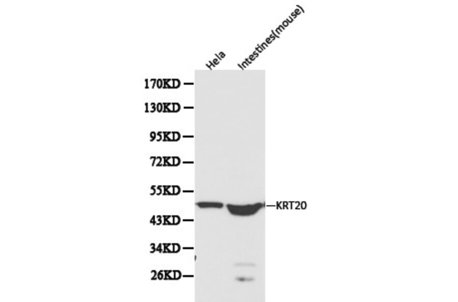 Anti-Cytokeratin 20 Antibody from Bioworld Technology (BS6026) - Antibodies.com