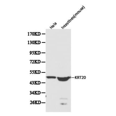 Anti-Cytokeratin 20 Antibody from Bioworld Technology (BS6026) - Antibodies.com