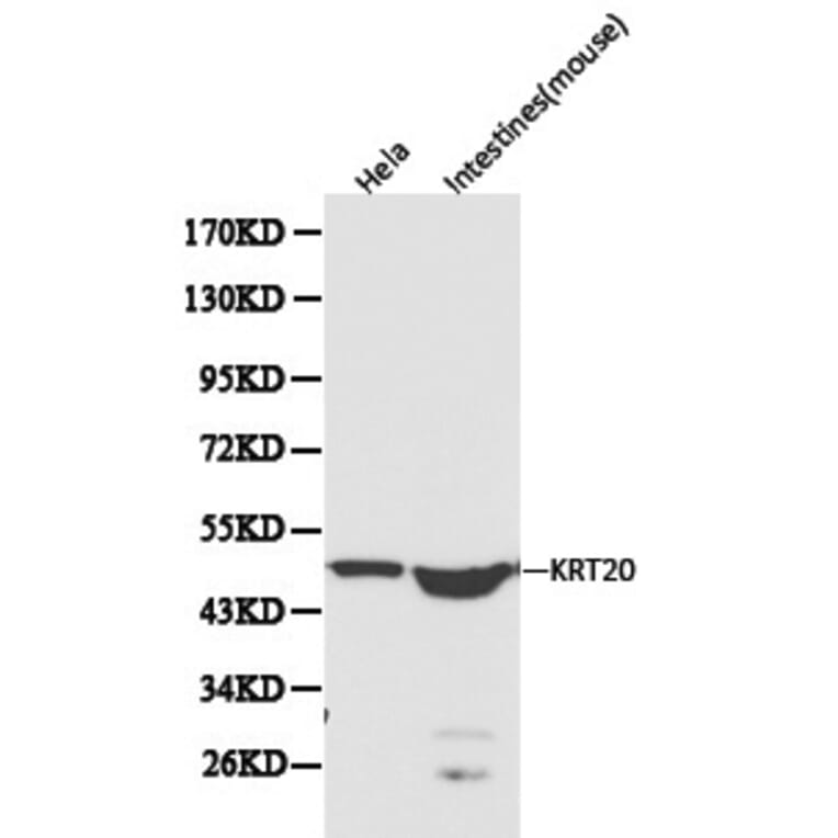 Anti-Cytokeratin 20 Antibody from Bioworld Technology (BS6026) - Antibodies.com