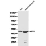 Anti-Cytokeratin 20 Antibody from Bioworld Technology (BS6026) - Antibodies.com