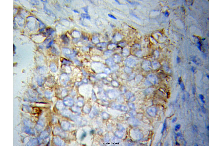 Anti-Cytokeratin 20 Antibody from Bioworld Technology (BS6026) - Antibodies.com