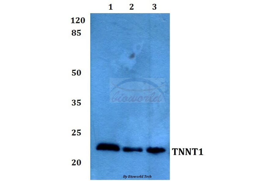Anti-Troponin T1 Antibody from Bioworld Technology (BS60260) - Antibodies.com