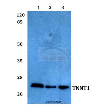 Anti-Troponin T1 Antibody from Bioworld Technology (BS60260) - Antibodies.com